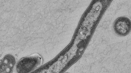 So sehen Tuberkulose-Bakterien aus. Doch nur wer lange Kontakt zu einem Erkrankten hat, kann sich möglicherweise anstecken. Der Mediziner Robert Koch beschrieb 1882 als Erster den Krankheitsauslöser. Für seine Entdeckung erhielt er den Nobelpreis.