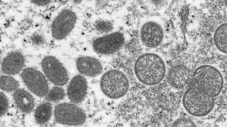 Eine elektronenmikroskopische Aufnahme zeigt reife, ovale Affenpockenviren (l).