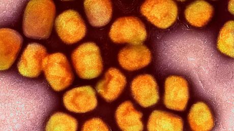 Kolorierte mikroskopische Aufnahme von kultivierten und gereinigten Affenpockenvirus-Partikeln (gelb.