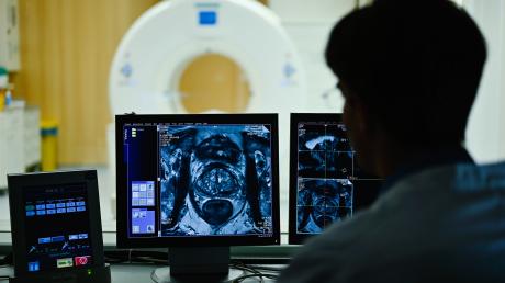 Ein Mitarbeiter betrachtet im Deutschen Krebsforschungszentrum das Querschnittsbild einer Prostata.  