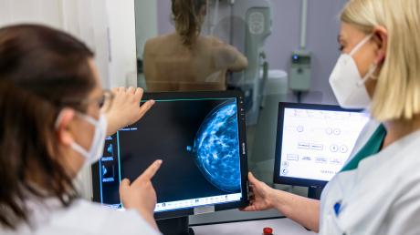 Medizinisches Personal untersucht mit einer Mammografie die Brust einer Frau auf Brustkrebs. Im Jahr 2022 starben etwa 19.000 Menschen an Brustkrebs. 