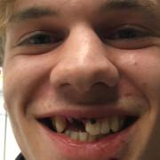Feierte sein Debüt im Trikot der deutschen Eishockey-Nationalmannschaft: Ingolstadts Angreifer Tim Wohlgemuth. Im Testspiel gegen Tschechien verlor der 19-Jährige zwei Zähne, konnte aber im Anschluss schon wieder lachen.