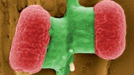 EHEC-Bakterien unter dem Elektronenmikroskop: Auf der Suche nach der Quelle des Darmkeims prüfen Kontrolleure in Laboren unter Hochdruck Radieschenschnipsel, Salatblätter und Sprossen - bislang ohne Treffer. dpa