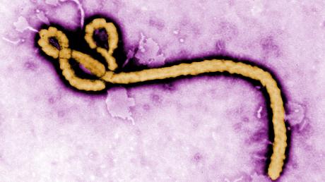 Ebola fordert in Westafrika immer mehr Opfer. Mittlerweile sind über 120 Menschen dem tückischen Virus (Bild) erlegen. Die Weltgesundheitsorganisation WHO schlägt Alarm.