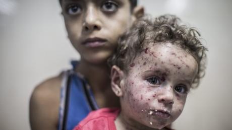Ein neunjähriger, palästinensischer Bub und seine kleine Schwester in der Notaufnahme eines Krankenhauses in Gaza-Stadt. Laut Agentur wurde das Mädchen beim Beschuss eines Panzers durch Splitter verletzt. 