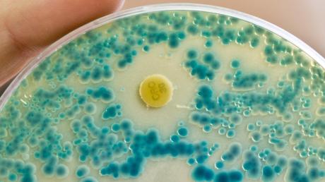 Unter dem Mikroskop: Bakterien, die resistent gegen gängige Antibiotika sind, werden immer mehr zur Gesundheitsgefahr.  	