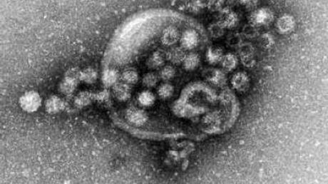 Elektronenmikroskopische Aufnahme von Noroviren: Die Zahl der Norovirus-Infektionen ist in Deutschland auf einen Rekordstand gestiegen.
