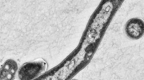 Der Tuberkulose-Erreger Mycobacterium tuberculosis unter dem Elektronenmikroskop.