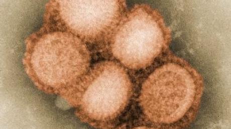 Institut: mehr Tote durch Schweinegrippe möglich