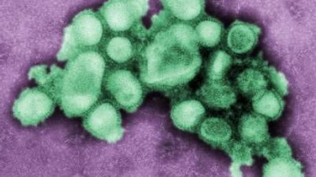 Mutierte Schweinegrippeviren entdeckt