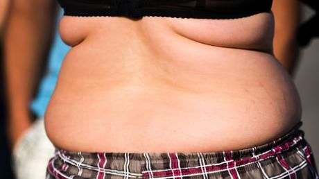 Übergewichtige sollen nach den Vorstellungen der CDU stärker zur Kasse gebeten werden. Bild: dpa
