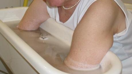 Kneippanwendungen sind in der Pflege sinnvoll, belegt eine Studie. Das Foto zeigt ein Armbad.