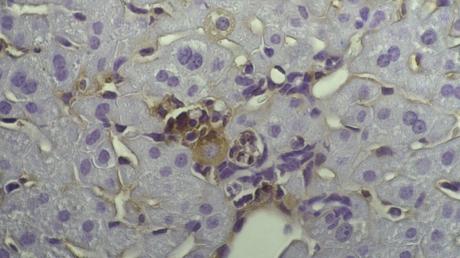Körpereigene Killerzellen (im Bild) können Krebs bekämpfen – dazu gibt es in der Forschung einige Ansätze. 