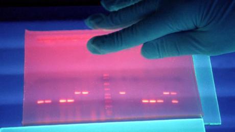 Untersuchung von fluoreszierender DNS.