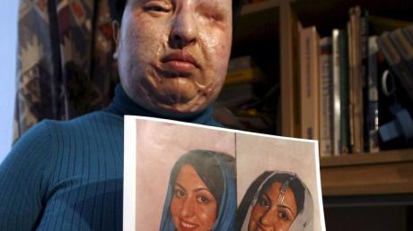 Die nach einem Säure-Attentat eines verschmähten Verehrers entstellte Iranerin Ameneh Bahrami (Archivfoto vom 04.03.2009) verzichtet auf die Bestrafung ihres Peinigers. dpa