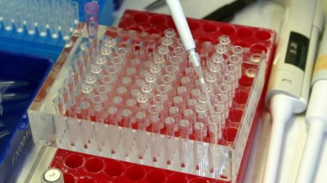 Labortests zum Vogelgrippe-Virus. Foto: Jens Wolf/ Archiv dpa