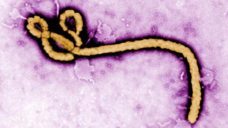 Das Ebola-Virus unter einem Elektronenmikroskop.