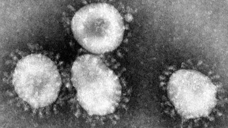 Mers-Virus unter dem Mikroskop. In Südkorea sind drei weitere Menschen an dem Virus gestorben.