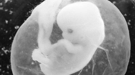 Ein sieben Wochen alter Fötus in der Fruchtblase: Im Bundestag geht es jetzt um die äußerst strittige Frage, ob Ärzte darauf hinweisen dürfen, dass in ihrer Praxis auch Abtreibungen durchgeführt werden.