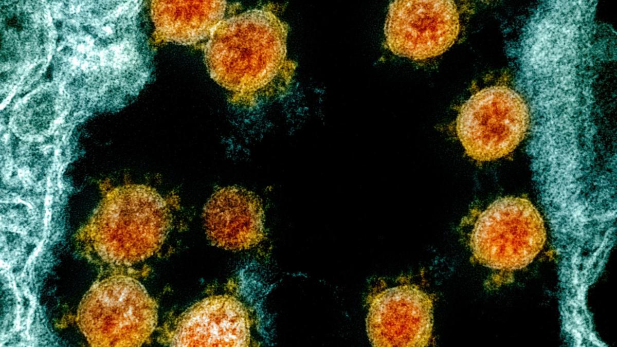 #Pandemie: FBI: Corona-Ursprung „höchstwahrscheinlich“ durch Laborpanne