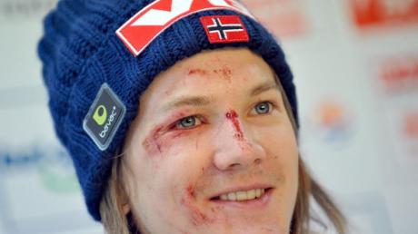 Tom Hilde sieht die Schuld nach seinem Sturz in Oberstdorf allein bei sich selbst. "Ich habe zu viel riskiert", sagt der Norweger über den Sturz, der seine Saison beendete.